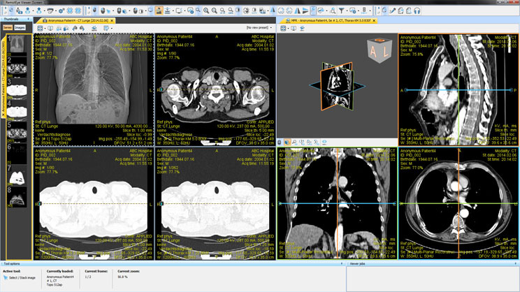 medical image viewr for mac